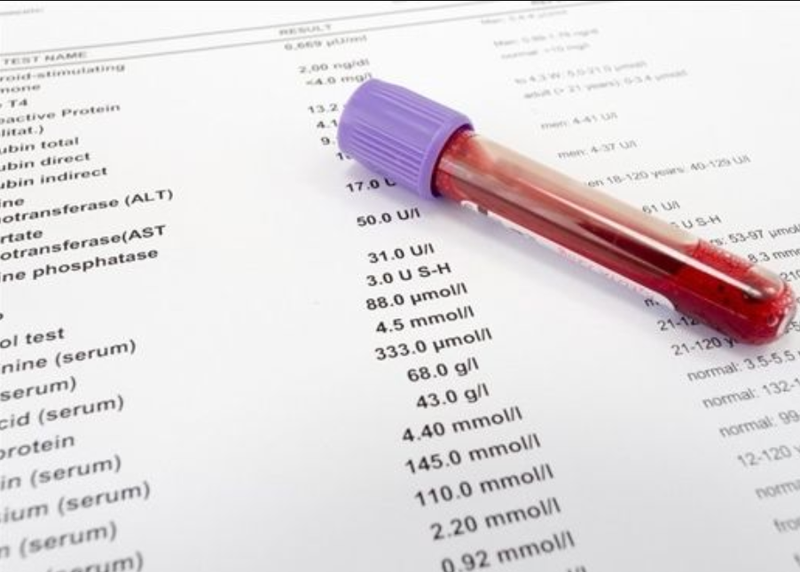 Chỉ số Triglyceride có ý nghĩa gì trong 4 chỉ số lipid máu?