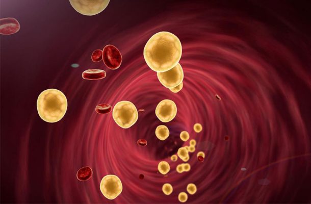Rối loạn lipid máu có bản chất như thế nào?